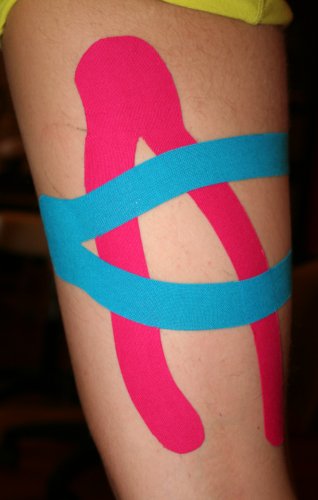 overbelasting van de hamstrings